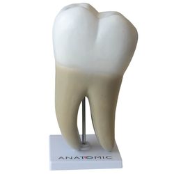 dente-molar-ampliado-saudavel-e-com-carie-TGD-0311-B
